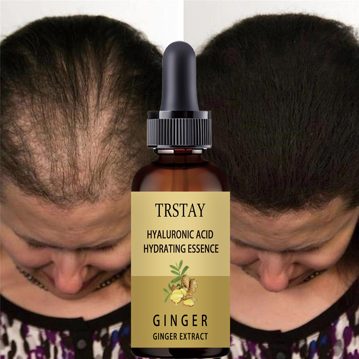 Caffeine Hair Serum - Serum na porost włosów zapobiegające wypadaniu