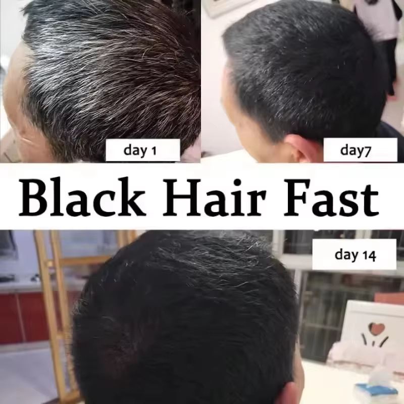 Serum do pielęgnacji siwych wł – Hair Care Ginseng recenzja i cena