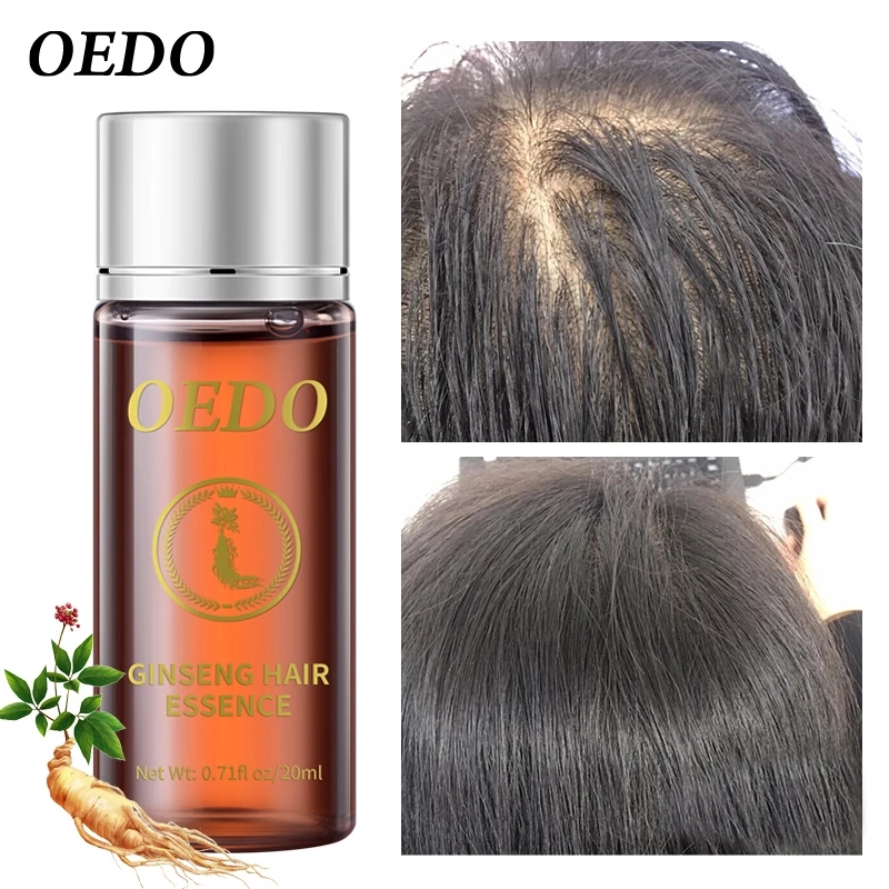 20ML Esencja z żeń-szeniem na  – Hair Care Ginseng recenzja i cena