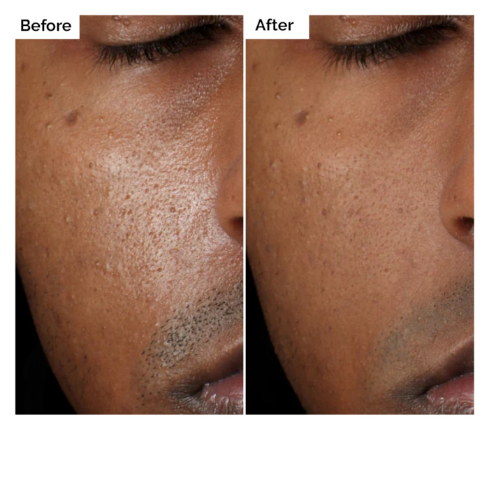 Serum z aloesem 2% + NAG 2% 30 – Caffeine Hair Serum recenzja i cena