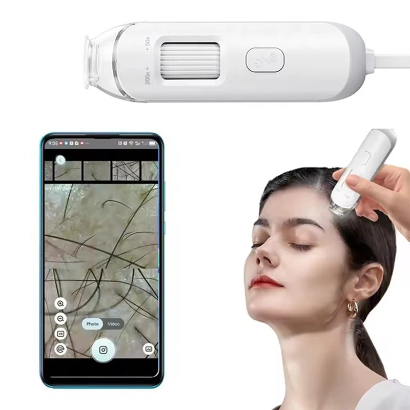 Nowy Elektroniczny Dermatoskop – Hair Porosity Test recenzja i cena