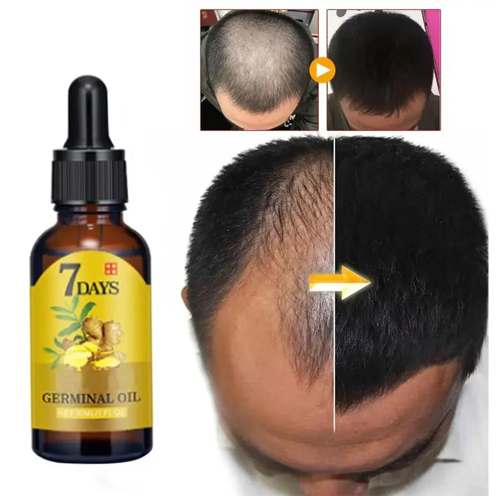 Wzrost włosów Imbir Szybko ros – Caffeine Hair Serum recenzja i cena