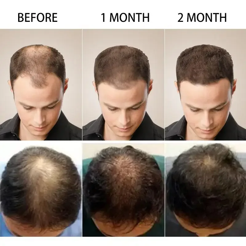 Wzrost włosów Imbir Szybko ros – Caffeine Hair Serum recenzja i cena