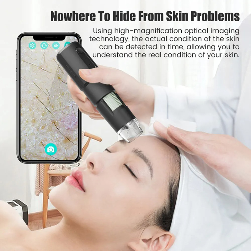 Bezprzewodowy dermatoskop anal – Hair Porosity Test recenzja i cena